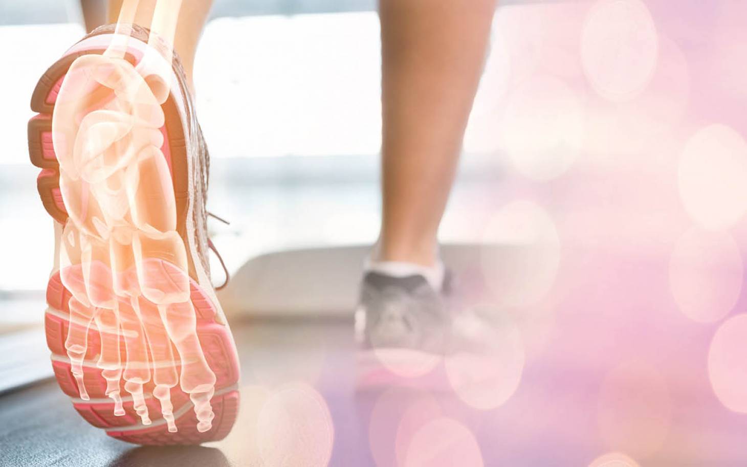 Fracture de fatigue (de stress) des métarsiens