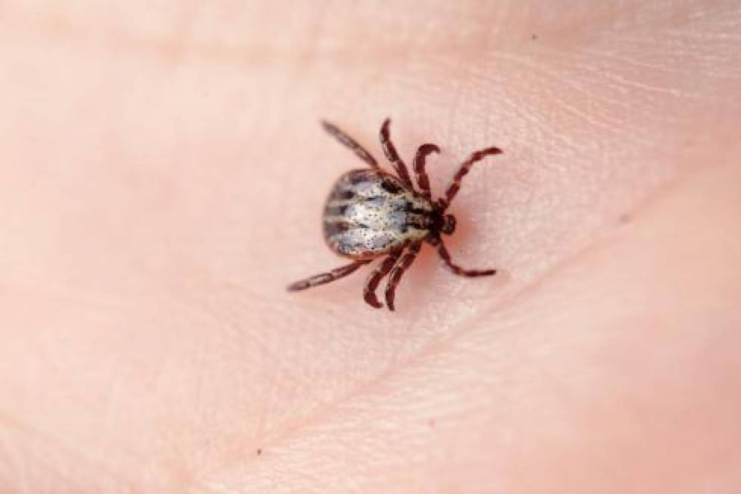 La maladie de Lyme au banc des accusés
